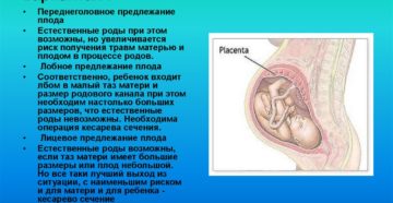 Что значит продольное предлежание плода головное предлежание