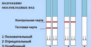 Признаки подтекания околоплодных вод в третьем триместре