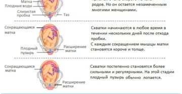 Признаки родовой деятельности у повторнородящих