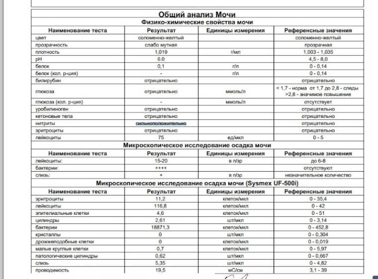 Норма цилиндров в моче