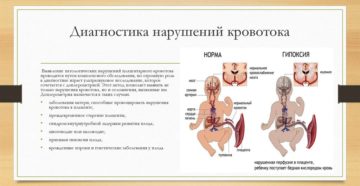 Нарушение кровотока при беременности