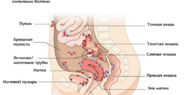 Как понять болит кишечник или матка при беременности