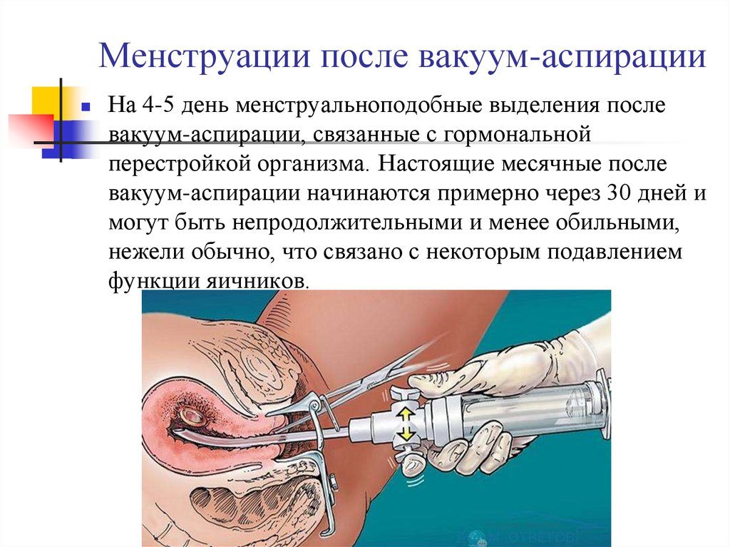 Менструальноподобная реакция после вакуума