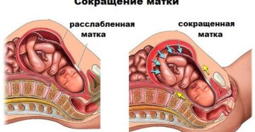 Тонус матки вне беременности