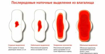 Могут ли лохии снова стать красного цвета