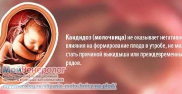 Молочница влияет на беременность