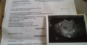 Можно ли на узи увидеть беременность 1 неделя