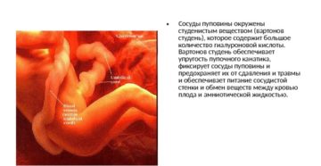Сколько пуповина имеет сосудов в 20 недель