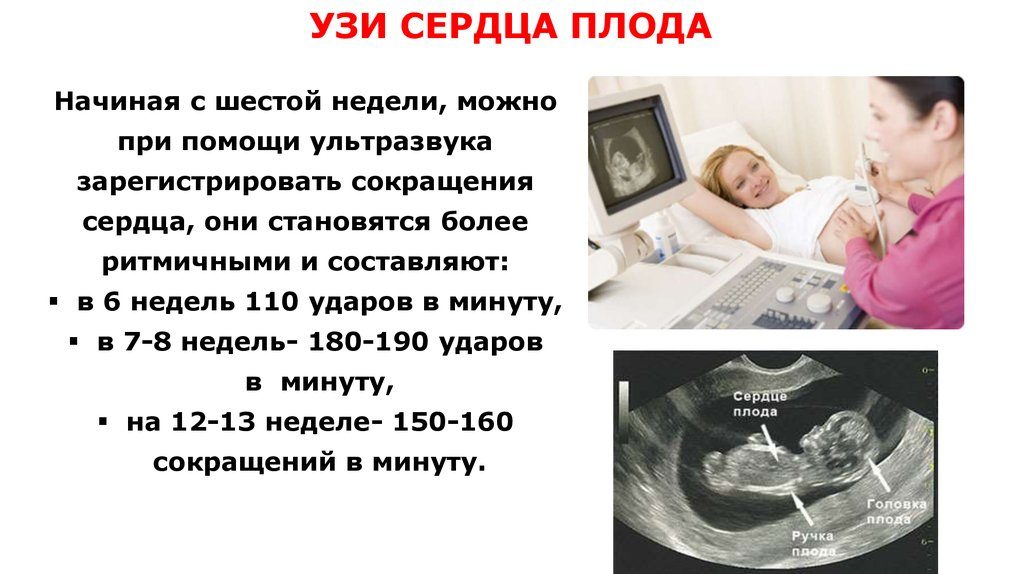 На какой неделе слышно сердцебиение плода на узи