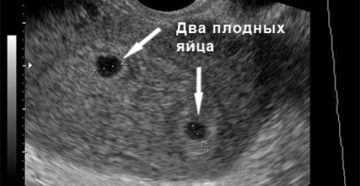 На каком сроке можно увидеть плодное яйцо