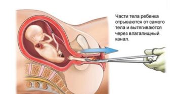 После чистки когда можно забеременеть