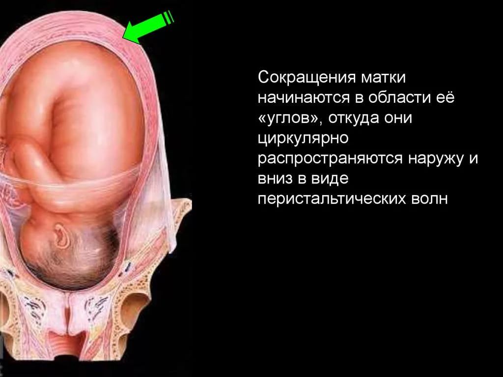 Матка при беременности сокращается