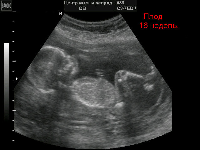 Фото узи 15 16 недель беременности фото