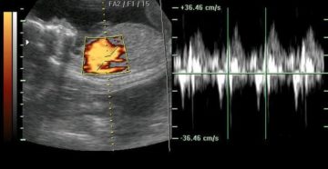На каком сроке можно определить сердцебиение по узи