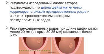 Роды с короткой шейкой матки