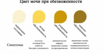 У ребенка темная моча причины