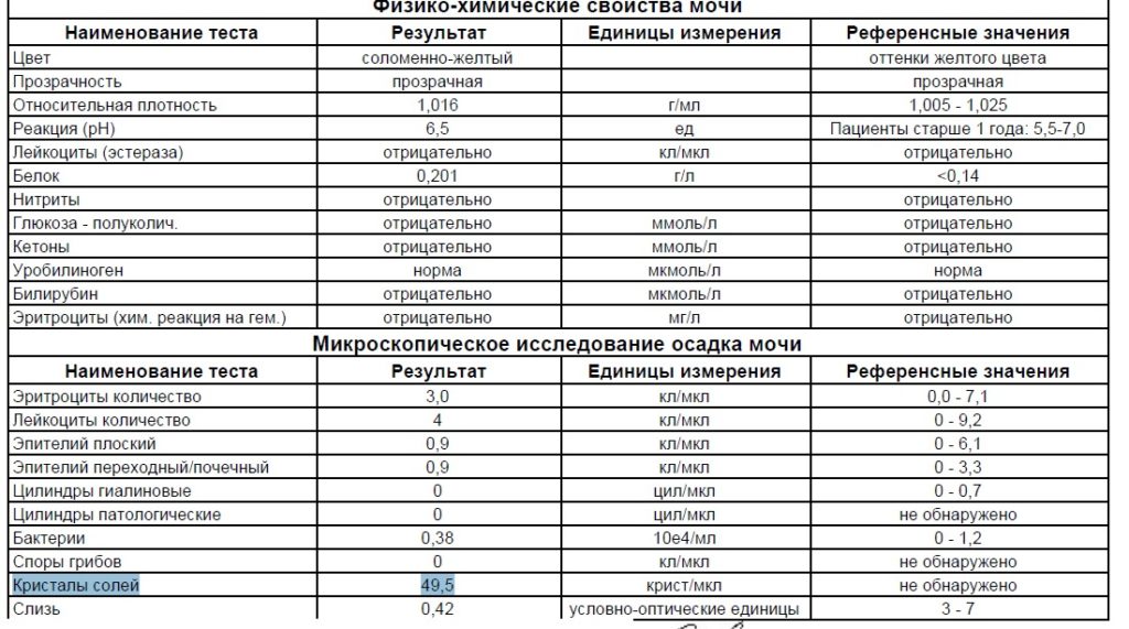 Соль в моче при беременности что это значит