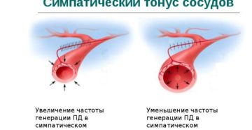 Тонус артерий распределения резко снижен гипотонус что это