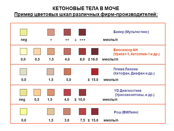 Кетоновые тела 2 в моче при беременности