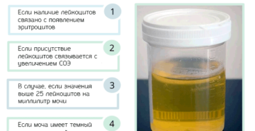 Лейкоциты белок и бактерии в моче при беременности