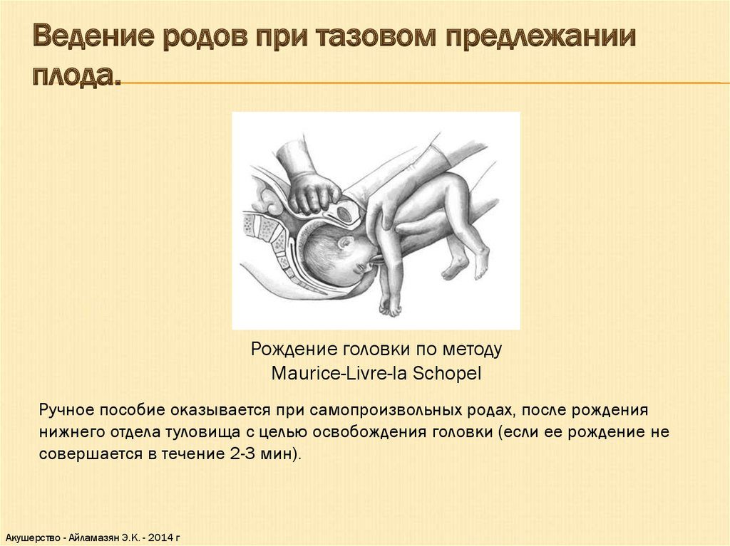 40 недель тазовое предлежание