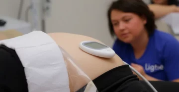 Криолиполиз для безоперационного уменьшения жира: клинические случаи и результаты